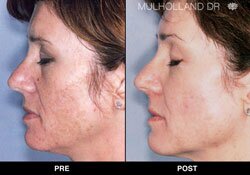 Trinity Skin Rejuvenation