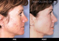 Trinity Skin Rejuvenation