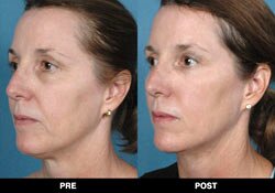 Trinity Skin Rejuvenation