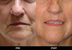 Trinity Skin Rejuvenation