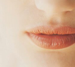 lip-enhancement-restylane